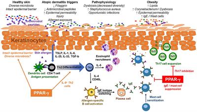 Obesity and the microbiome in atopic dermatitis: Therapeutic implications for PPAR-γ agonists